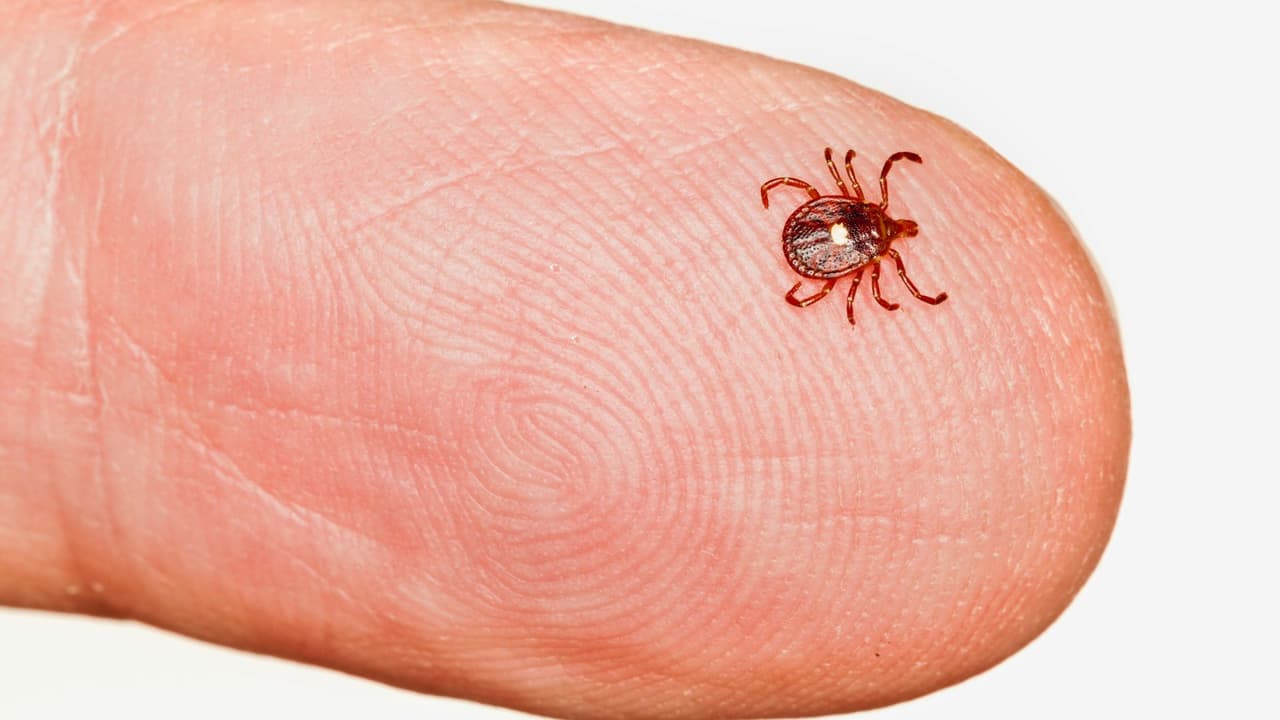 <h3 class="cms-H3-H3">Cómo se sienten los síntomas </h3>
<br>Los síntomas varían en intensidad, pero los más reportados son: 
<b>Ronchas, picazón intensa o hinchazón en la piel. Dolor abdominal, cólicos, náusea o diarrea. Mareo o sensación de desmayo.</b> En casos graves, anafilaxia, una reacción que compromete la respiración y puede ser mortal sin atención inmediata. El hecho de que los síntomas aparezcan horas después hace que 
<b>muchas personas pasen por varios episodios antes de relacionarlos con la comida.</b>