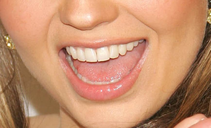 ¿Reconoces esta sonrisa? Es de una de las cantantes latinas más famosas del mometo. Aquí tienes una pista: ella es mexicana y en algún momento fue conocida como la 'reina de las telenovelas'.