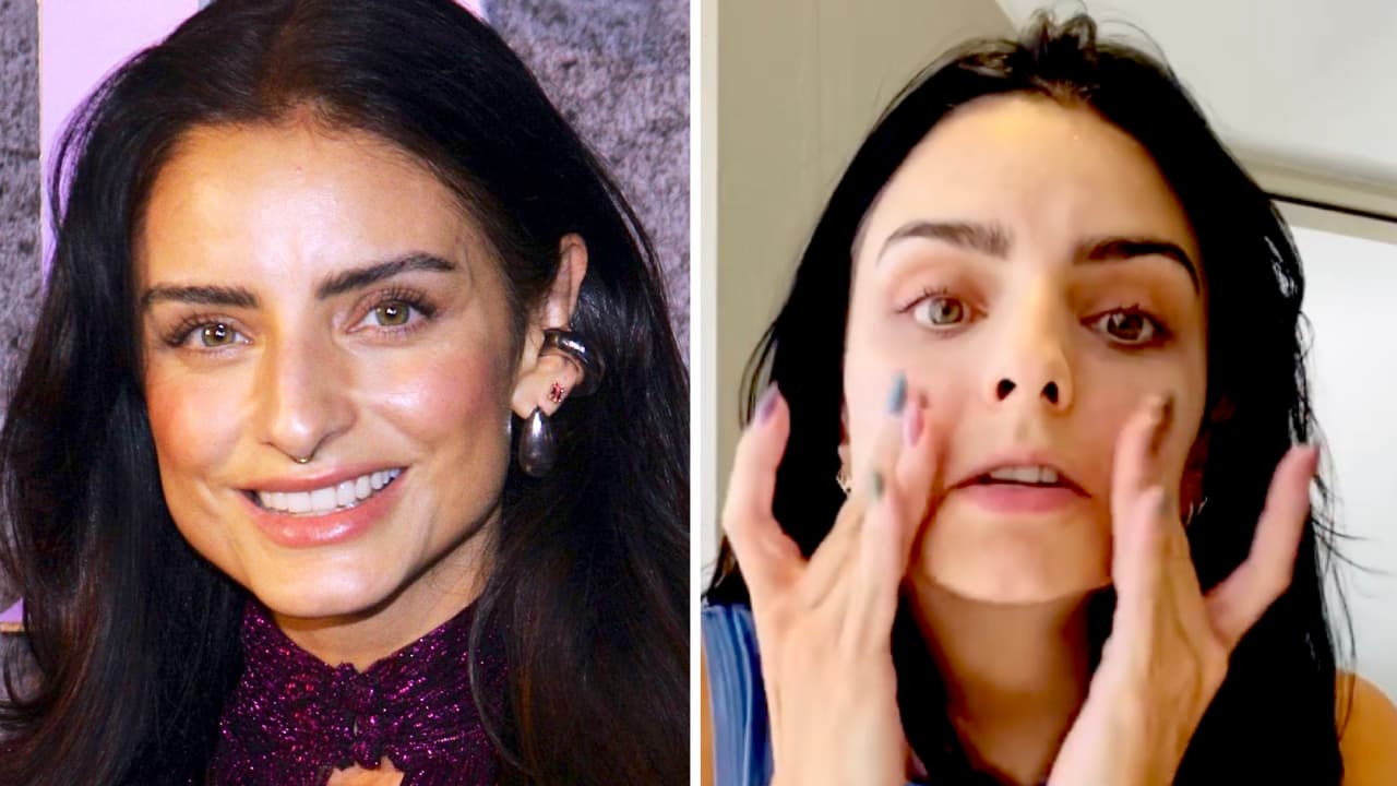 Aislinn Derbez queda “traumada” por el bótox: esto le pasó al ponérselo en la cara