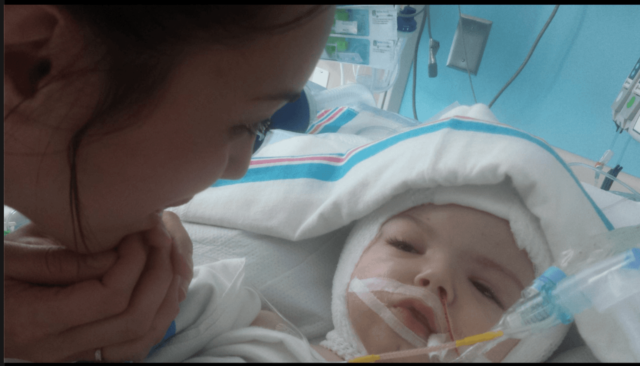 Los padres de los gemelos de Chicago que estaban unidos por la cabeza revelan progresos 