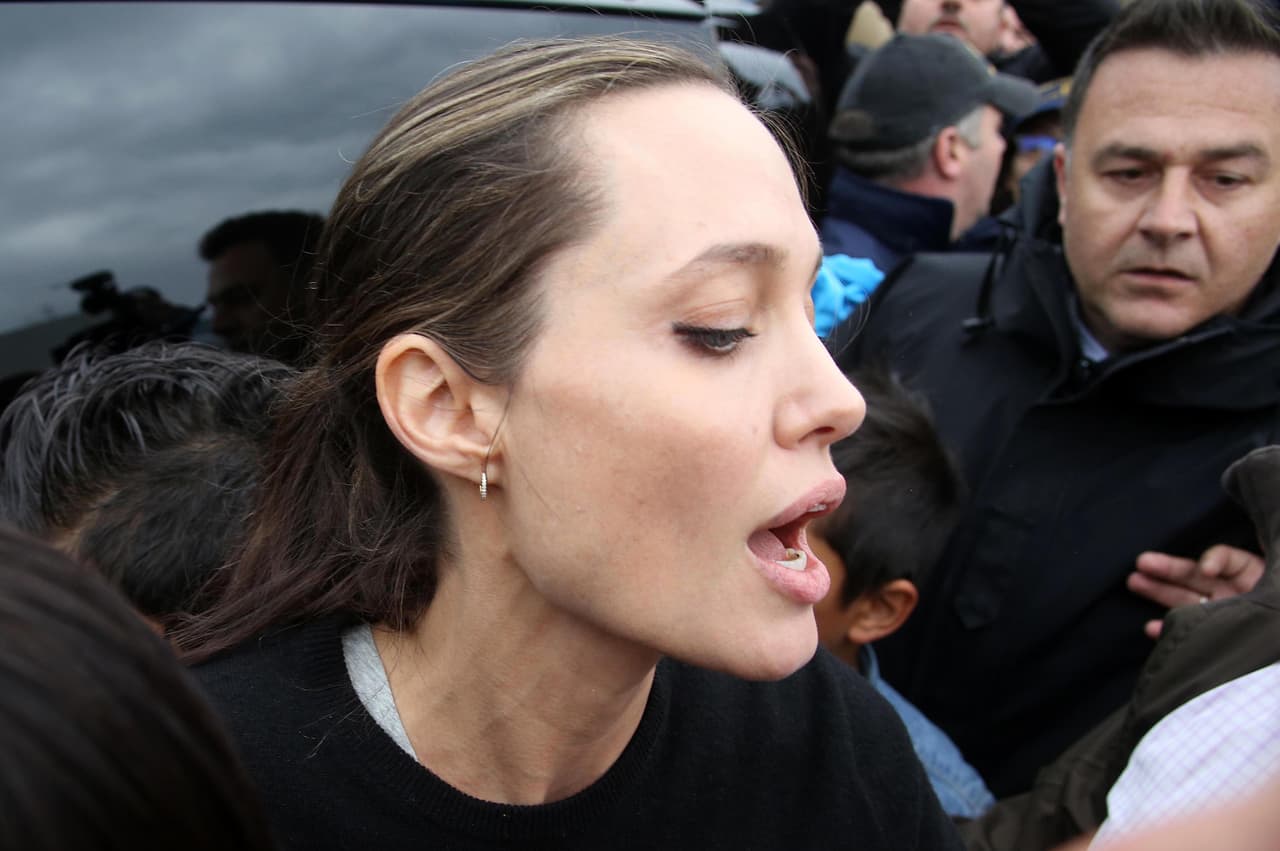 Tenía las cámaras encima.