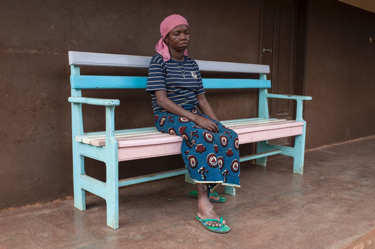 Algunas disminuyen la productividad económica de adultos jóvenes; otras entorpecen el crecimiento y el desarrollo cognitivo de los niños. Todas generan sufrimiento, estigmatización social y discriminación.