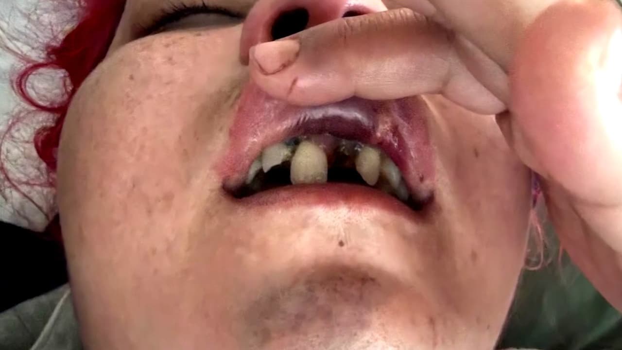 Madre es golpeada y asaltada en Long Beach; teme por robo de llaves e identificaciones