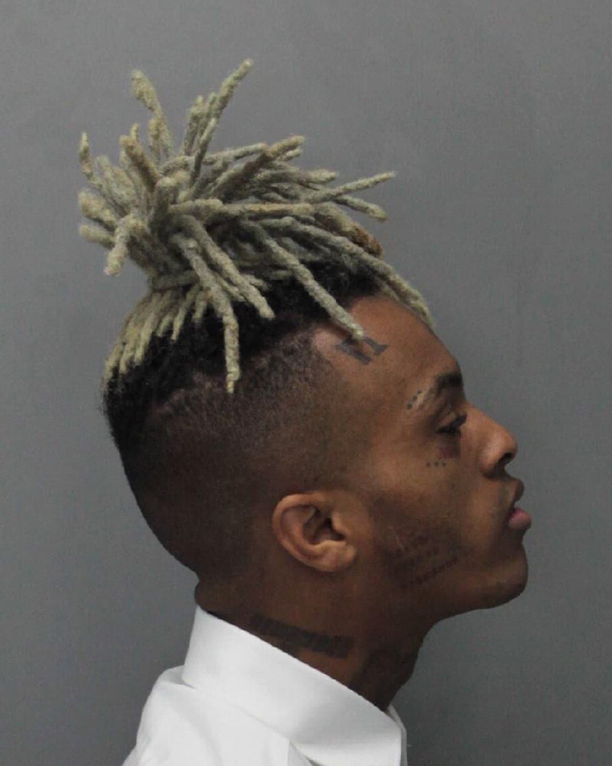 Los agentes a cargo de la pesquisa no han divulgado cuántos
<b> disparos recibió</b> el cantante de 20 años, ni el alcance
<b><a href="https://www.univision.com/entretenimiento/xxxtentacion-la-contradictoria-vida-de-un-talentoso-rapero-marcado-por-la-violencia">de sus heridas</a>. </b>Pero anticiparon que tienen a otros sospechosos en la mirilla.