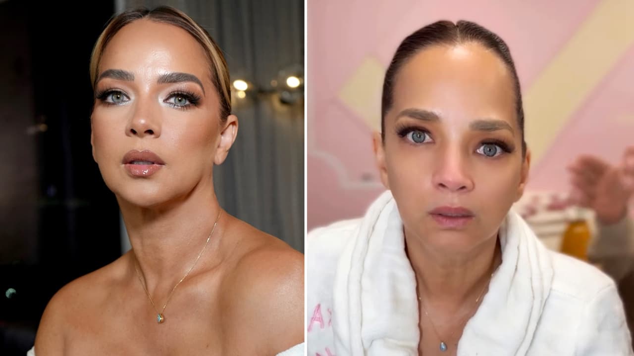 Adamari López se hace tratamiento facial y termina con la ‘cara desfigurada’: así reacciona 