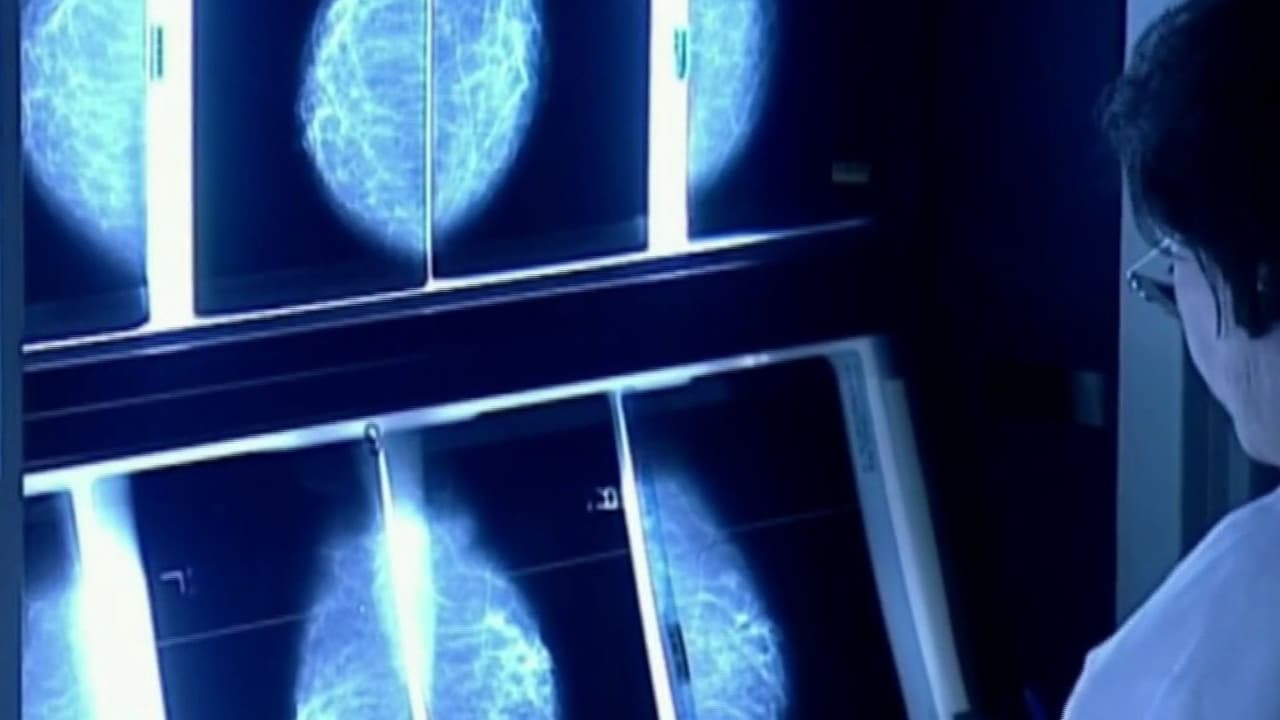 ¿La obesidad podría impulsar un aumento de casos de cáncer en el mundo?