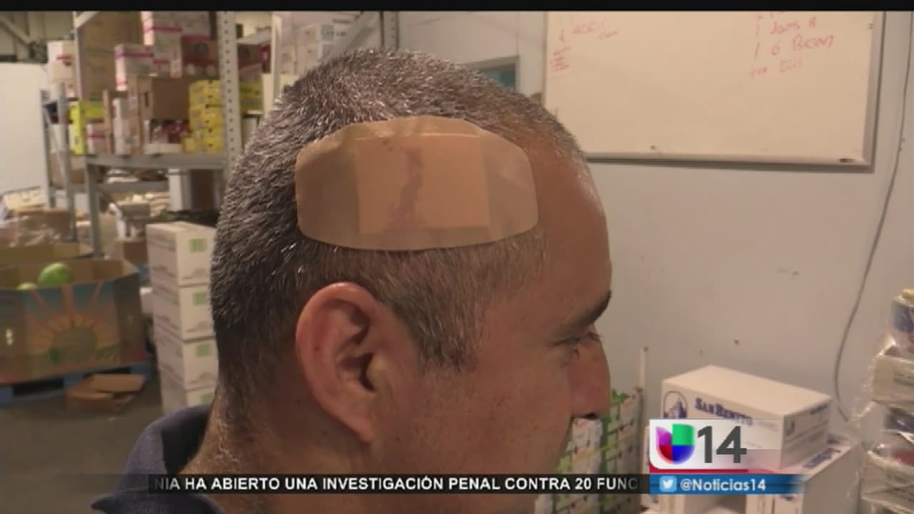 En exclusiva: testimonio de víctima baleada