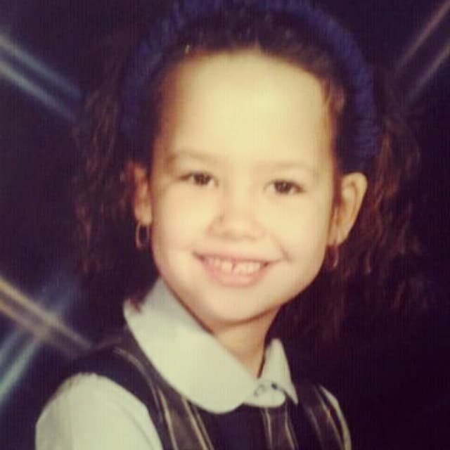 Un hermoso cabello rizado abundaba en donde hoy no existe nada.