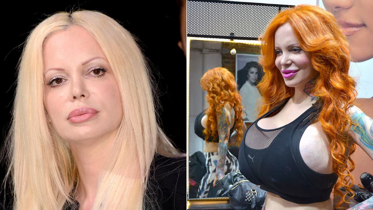 <b>Sabrina Sabrok</b>: la argentina que reside en México, también puso en riesgo su vida tras una operación en los glúteos, cuyos implantes solaron un líquido peligroso. Además, se ha operado los senos y el rostro.
<br>