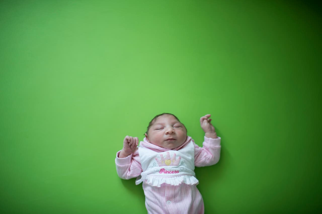 Brasil confirmó 462 casos de microcefalia e investiga 3,852 sospechosos