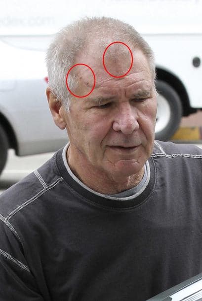 Ahora aparece recuperado y sólo con un par de cicatrices.