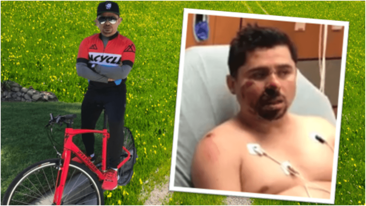 “Volví a nacer”: Larry Hernández a un mes del accidente en el que perdió los dientes