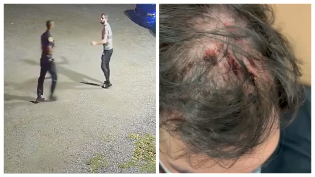 Policía de Miami golpea a un joven afuera del negocio de su familia: autoridades investigan