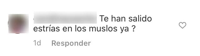 Una de sus seguidoras le preguntó si ya le habían salido estrías en los muslos.
<br>