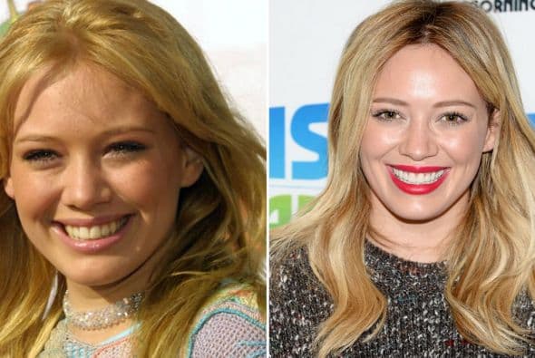 Mucha gente opina que tiene una dentadura que les recuerda a los dientes de los caballos. ¿Con qué 'look' dental lucía mejor esta chica?