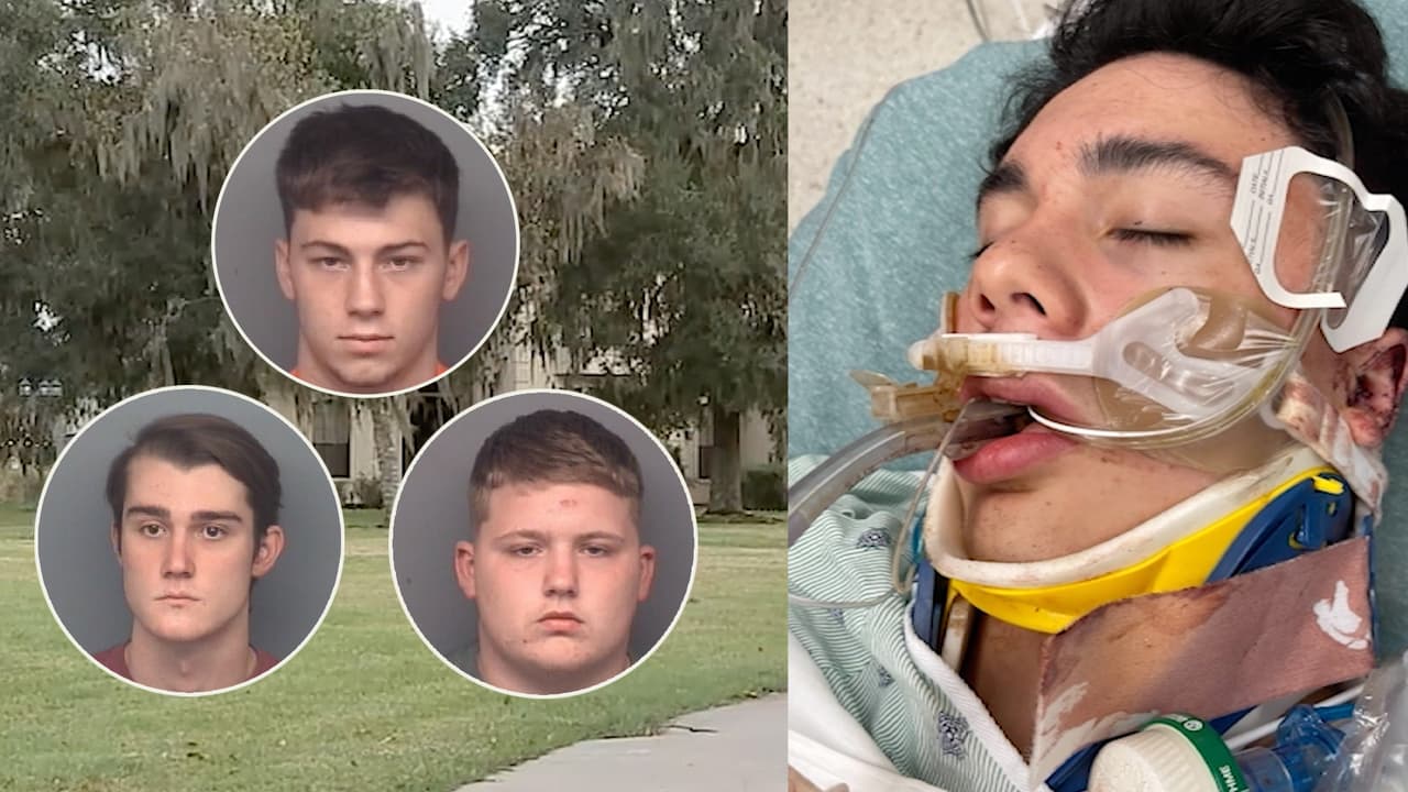 "Lo atacaron por la espalda": Arrestan a tres adolescentes sospechosos de golpear a un joven hasta dejarlo inconsciente