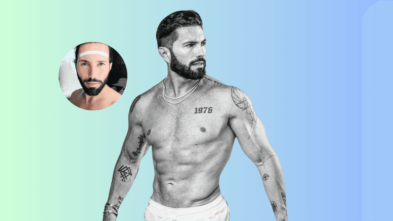 ¿Poncho de Nigris tiene miedo de envejecer? Todas las cirugías que se ha hecho