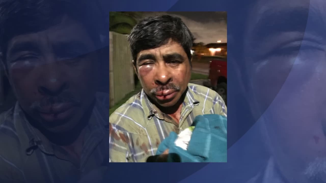 Inmigrante hispano denuncia haber sido víctima de un crimen de odio