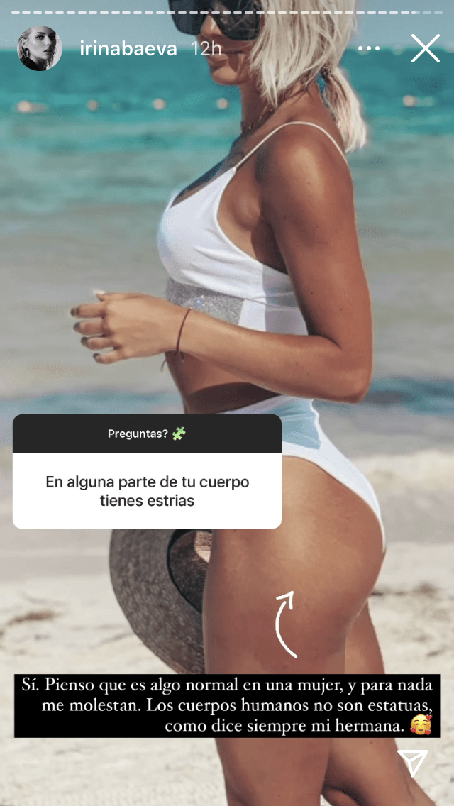 "¿En alguna parte de tu cuerpo tienes estrías?", le cuestionaron. "Sí. Pienso que es algo normal en una mujer y para nada me molestan. Los cuerpos humanos no son estatuas, como dice siempre mi hermana", dijo Irina junto a una fotografía en que muestra algunas de sus líneas en la piel.