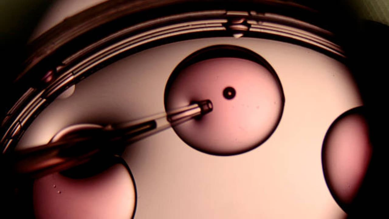 Pareja de Florida demanda a clínica de fertilidad tras dar a luz a un bebé equivocado