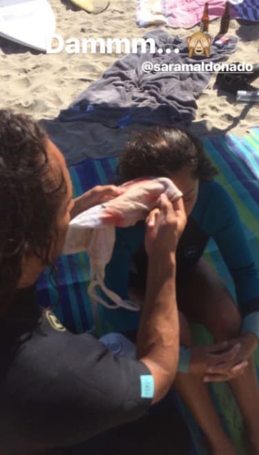 De inmediato la auxiliaron y comenzaron a limpiar la herida de la que manaba sangre.