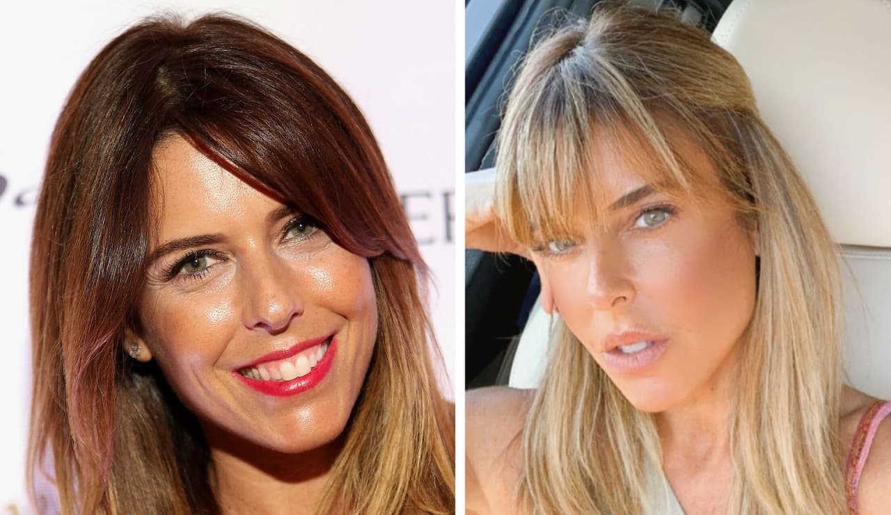 Maki presumió cómo quedó después de su procedimiento estético: subió una foto al natural