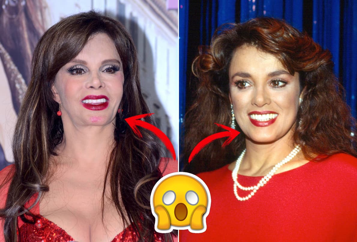 ¡Lucía Mendez no lo puede negar! Es amiga del retoque desde hace varios años atrás.