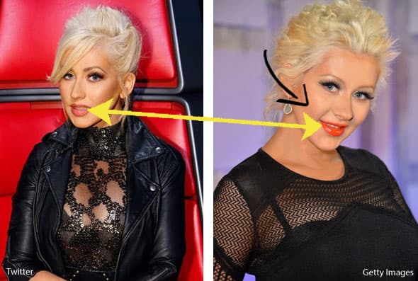 Por ejemplo, los dientes se ven distintos y el contorno del rostro también. Se dice que se puso implantes de pómulos.