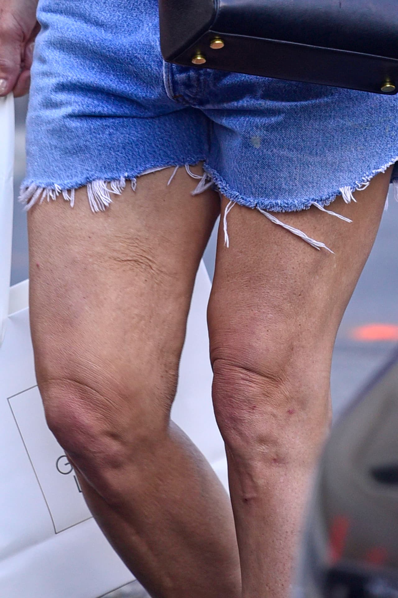 Sino el aspecto de sus piernas, las cuales lucían resecas, con manchas y con algunas marcas.