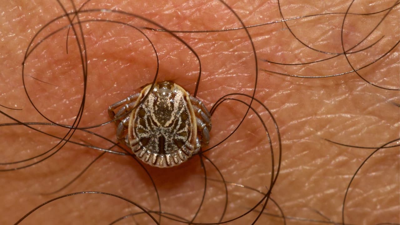 2. Muchas personas no desarrollan síntomas del virus Powassan, pero en ocasiones, para aquellas que sí lo hacen, los síntomas pueden ser graves.