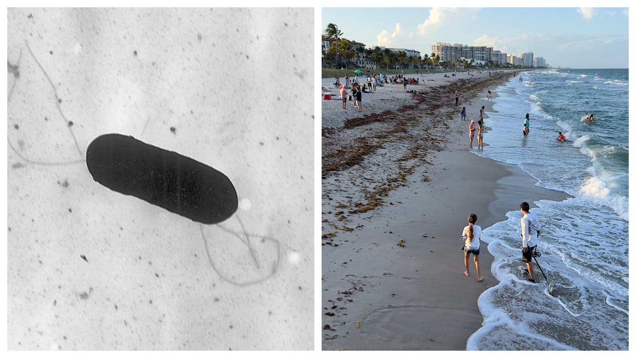 Una persona muere y 22 han sido hospitalizadas por brote de listeria que se habría originado en Florida