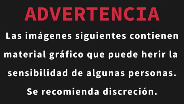 Las imágenes pueden herir la sensibilidad de algunas personas. Recomendamos prudencia.