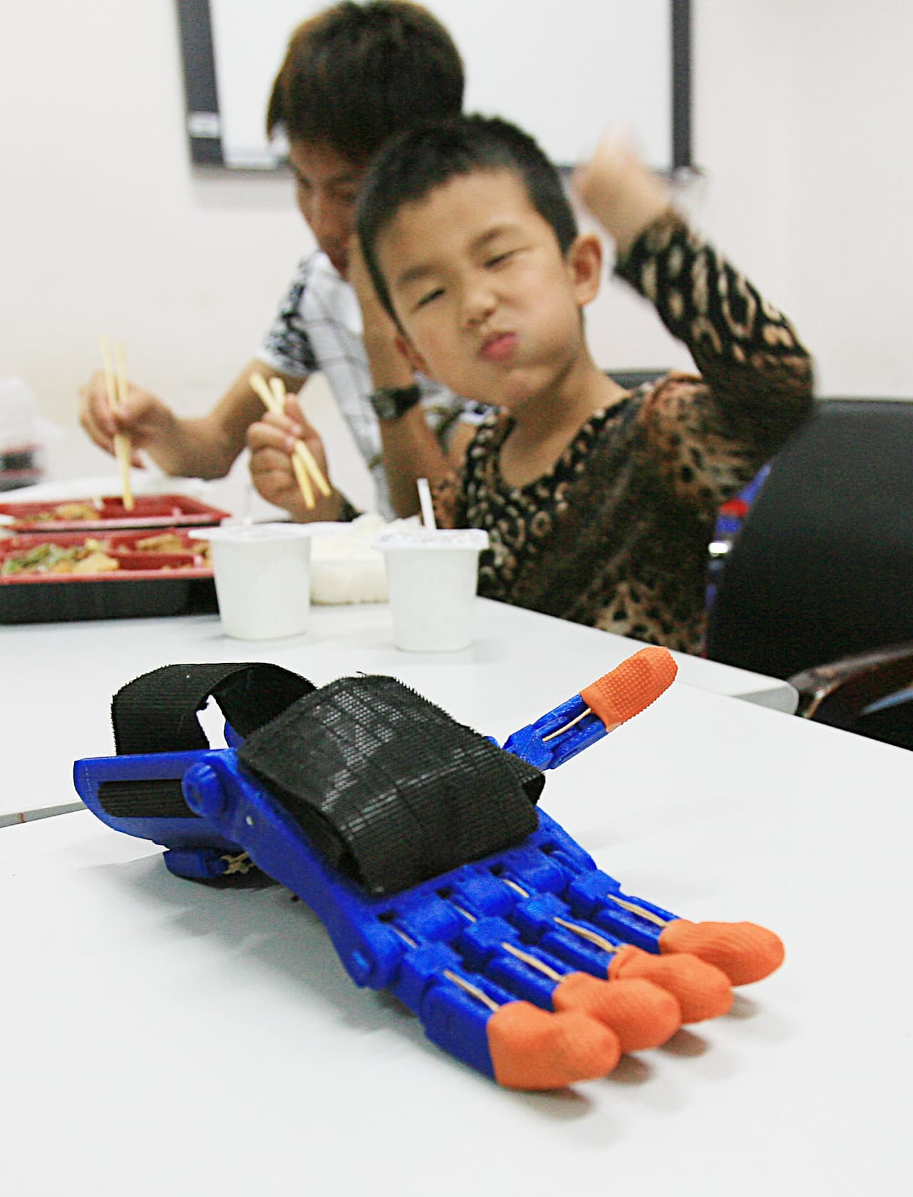 Los miembros impresos en 3D se han hecho famosos y por eso Chen Zhnengbing, director del hospital, le ha dado tal regalo.