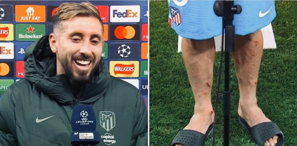 Héctor Herrera ‘mostró’ las heridas de sus piernas tras su visita a Old Trafford