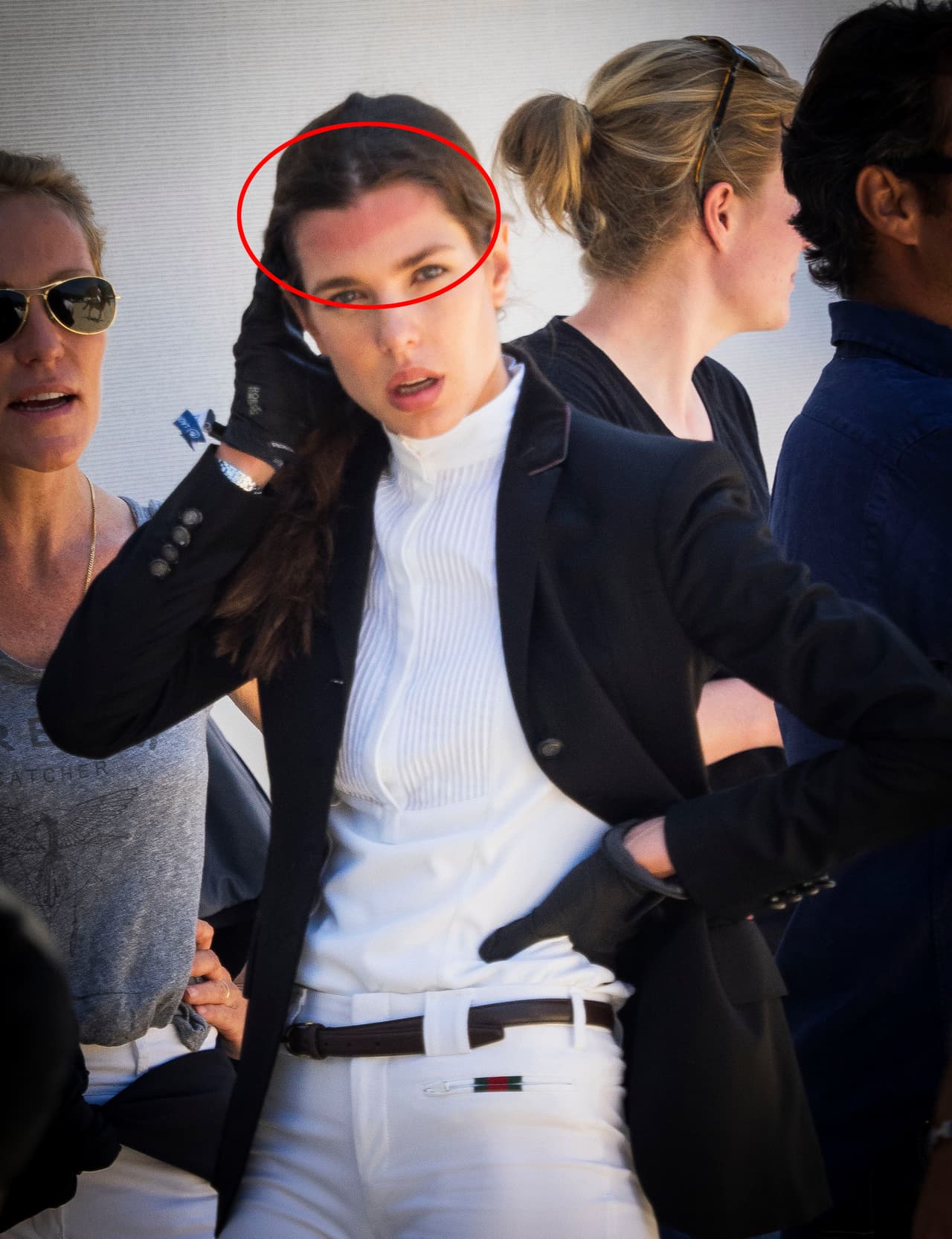 Y uno que otro golpecito en la cabeza.