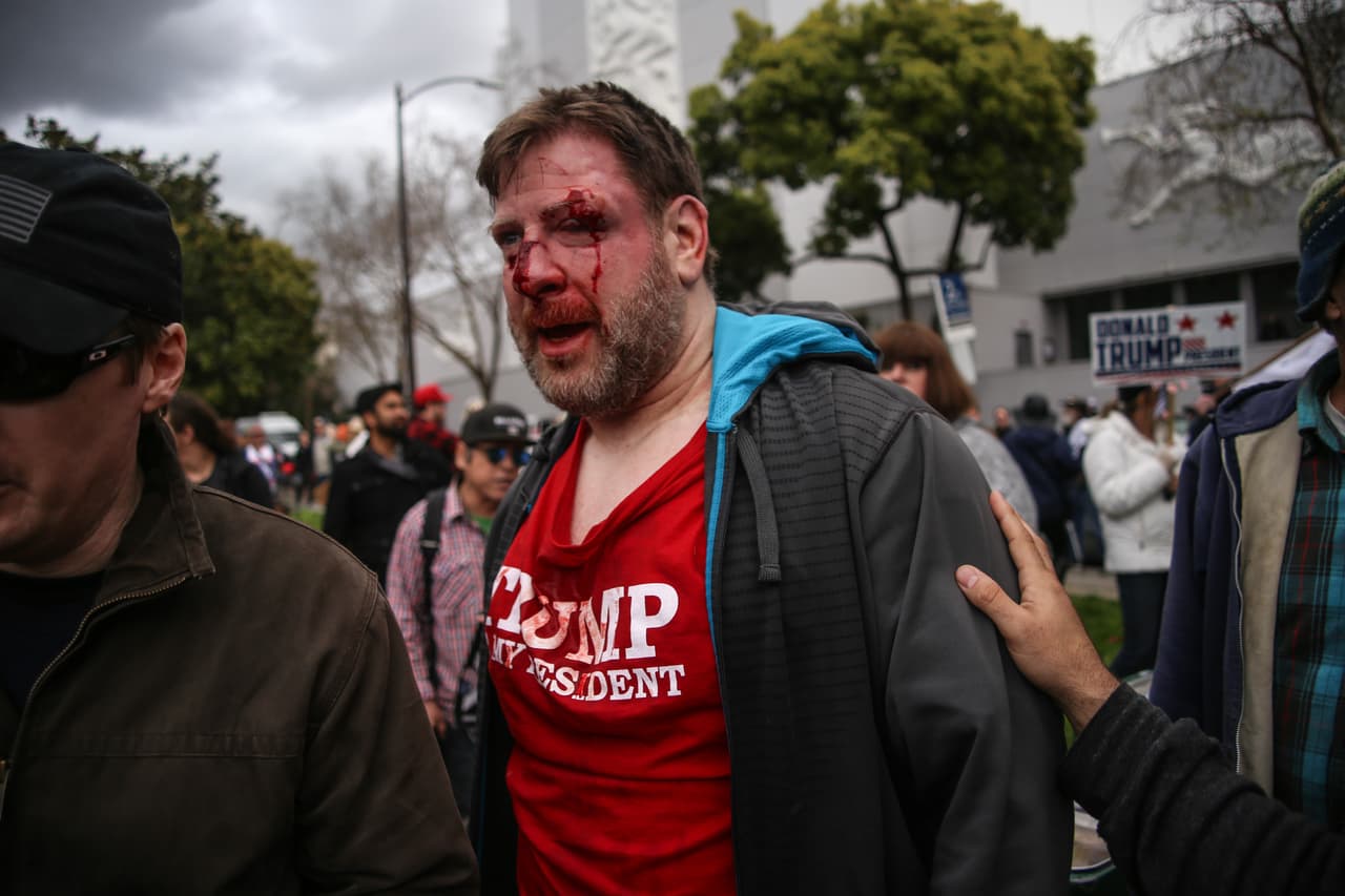<b>Política a golpes (4 de marzo). </b>Una manifestación a favor de la libertad de expresión en Berkeley, California, produjo un encontronazo violento entre partidarios y detractores de Donald Trump. Algunos manifestanten resultaron heridos en la refriega.