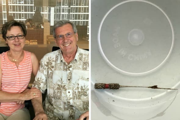 Un paciente recibe 675,000 dólares porque la dentista olvidó un instrumento en su cuerpo