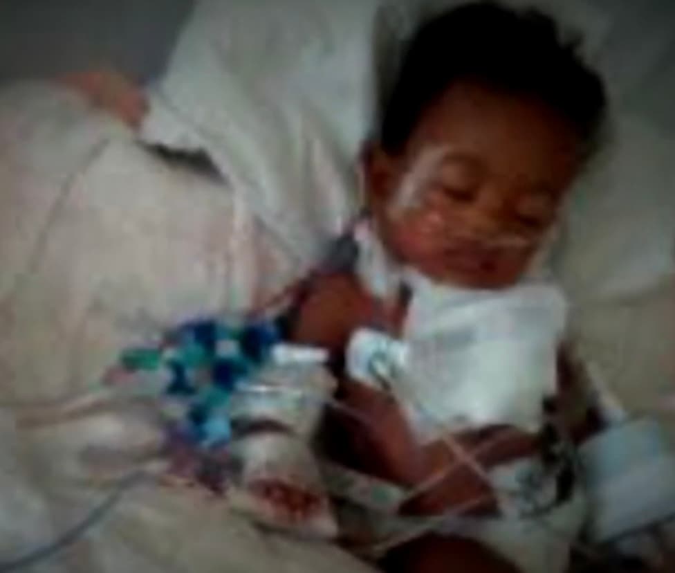 Hadassah nacería con una compleja cardiopatía congénita y problemas en la tiroides, que obligaron a esta humilde empleada doméstica a pedir toda la ayuda posible a disposición para solventar todo el tratamiento médico que su pequeña requería.
<br>