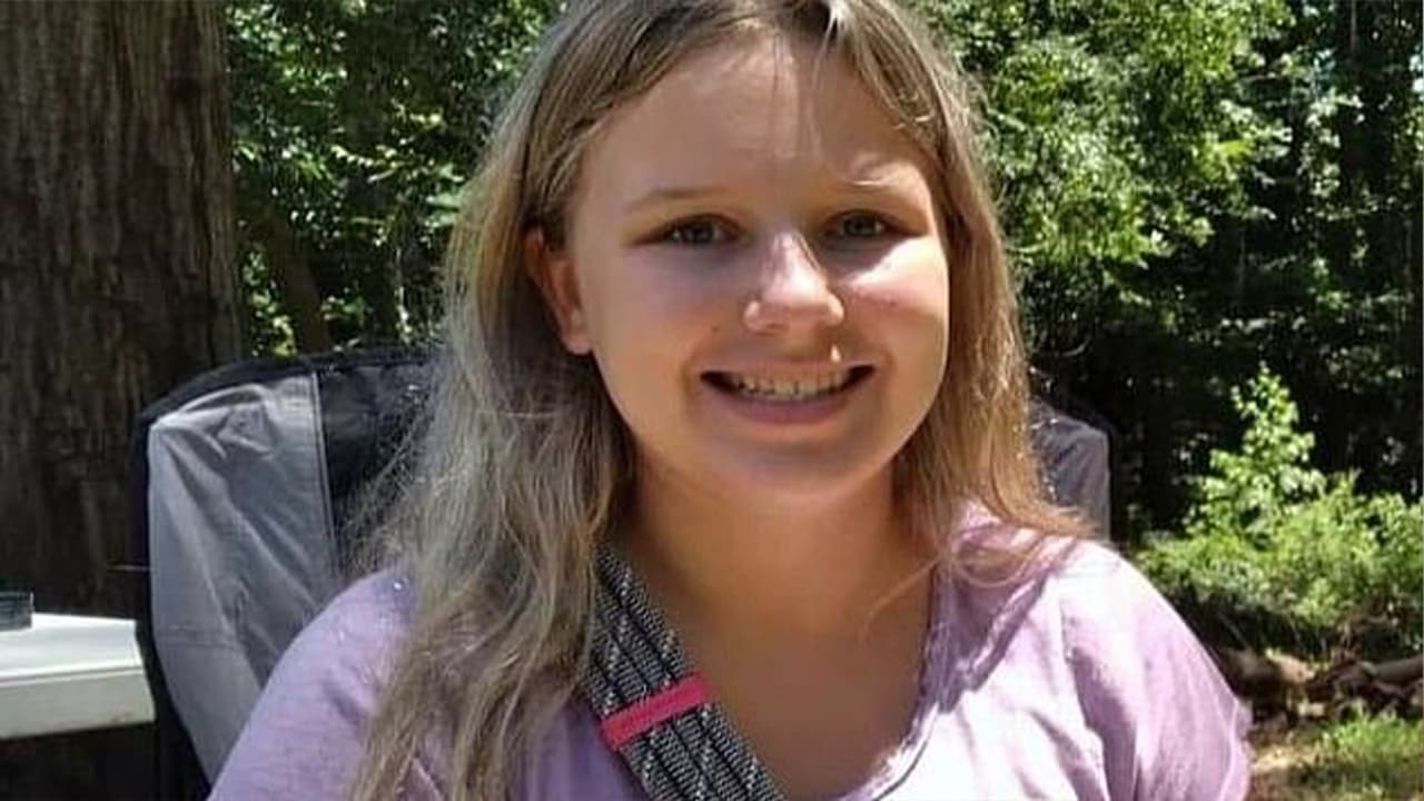 Según el agente de la oficina del alguacil Uno de los perros le estaba mordiendo el cuello y el otro la cabeza.