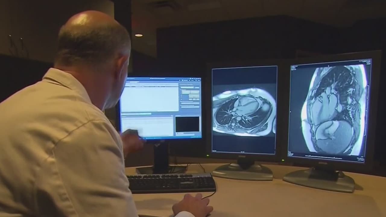 Cada 80 segundos un adulto con diabetes es hospitalizado por enfermedad cardiovascular en EEUU