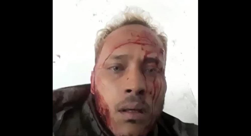 Gobierno venezolano confirma la muerte del piloto rebelde Óscar Pérez en una operación para capturarlo