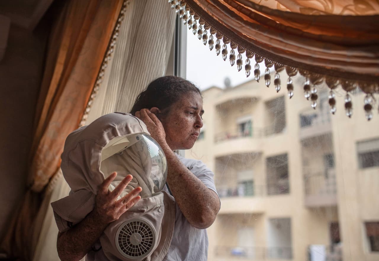 En un consultorio médico en Rabat, las familias que vienen de todo Marruecos se sientan en una sala de espera ansiosas de que se llamen sus nombres. Hay un rumor sobre un nuevo tratamiento XP.