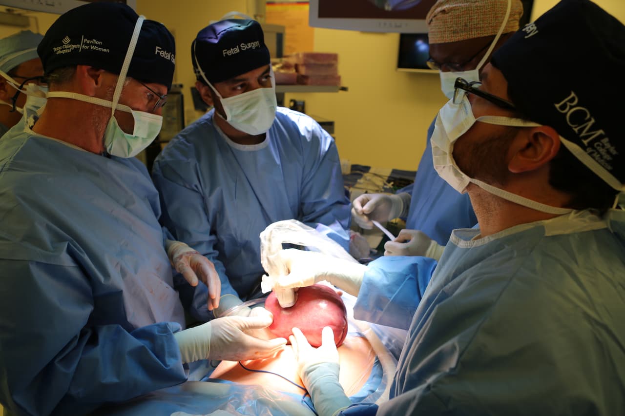 Los doctores Michael Belfort y William Whitehead están probando una nueva técnica en la que el útero de la madre es ligeramente elevado para introducirle un fetoscopio, que sirve de brújula dentro del vientre.