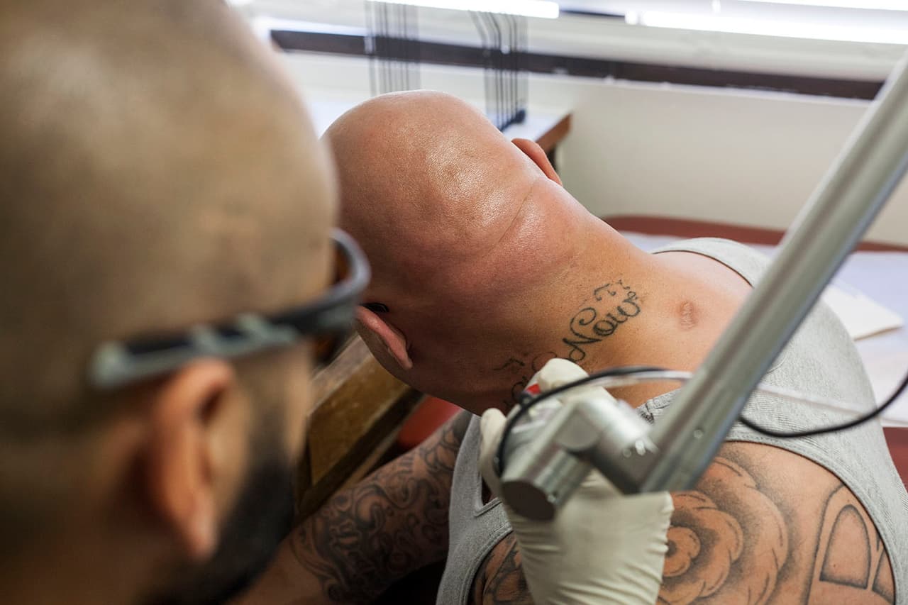 Muchos de los que asisten a este centro buscan quitarse los nombres de las pandillas que llevan en su cuerpo y otros símbolos emblemáticos.