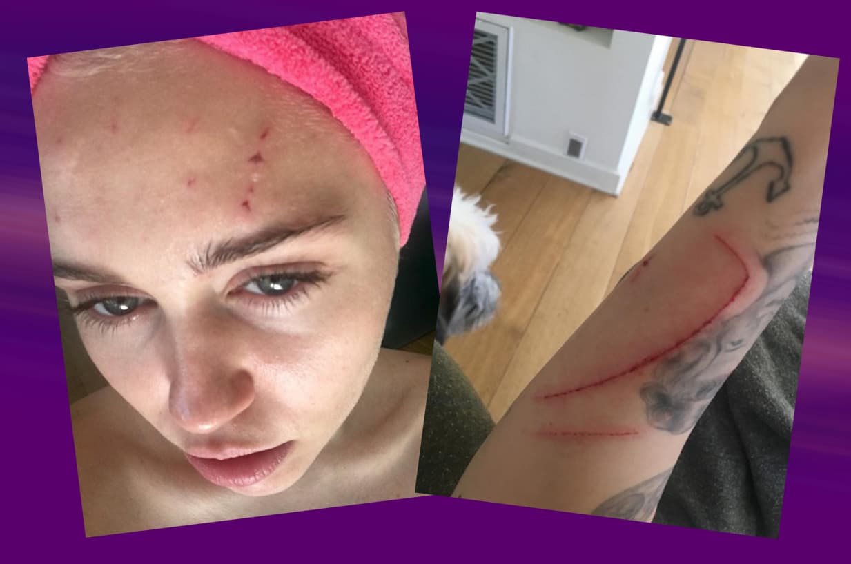 Algo le ocurrió a Miley Cyrus, y ella lo reportó en sus redes sociales.