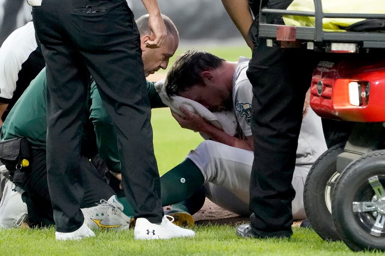 Bassitt cayó al montículo cuando fue golpeado, sujetándose la cabeza, y 
<b>sus compañeros de equipo rápidamente hicieron señas al “dugout” en busca de ayuda</b>.
<br>