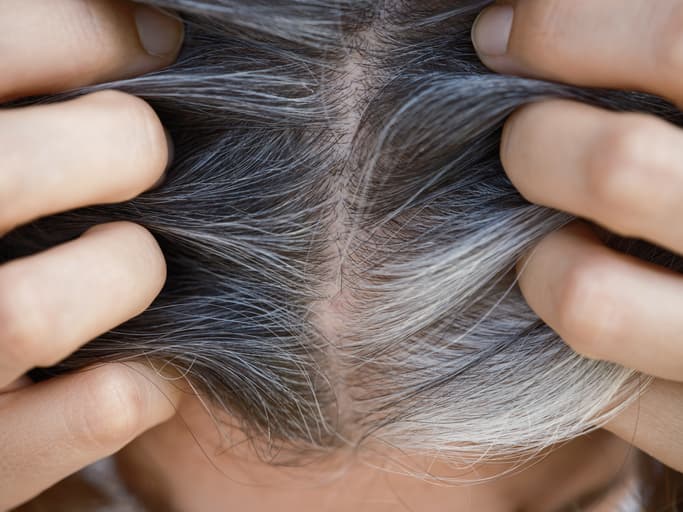 ¿Por qué aparecen las canas? Científicos descubren la verdadera razón y posibles pistas para revertirlas