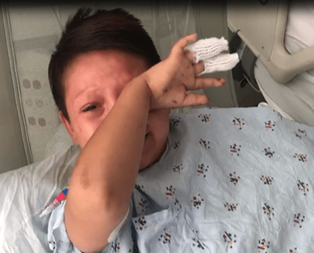 El pequeño Aron sufró heridas graves en ambas manos y abdomen.