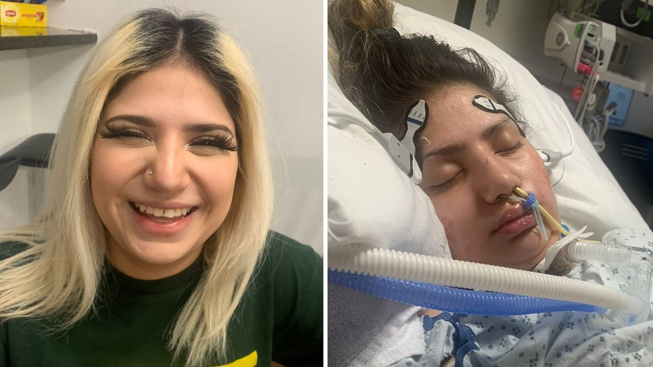 Meydy murió: Necesitaba un trasplante, pero “por no tener seguro no le hicieron nada”, denuncia la familia