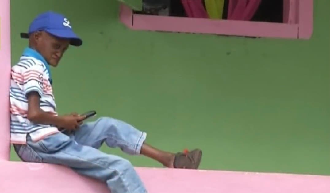 Hasta el momento, el joven Walmeli ha superado la expectativa de vida de 14 años para quienes padecen esta enfermedad, 
<b>algo que ha sorprendido a propios y extraños</b>, incluido el Doctor Calderón.